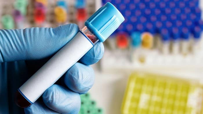 ارتوکین تراپی چگونه انجام میشود؟