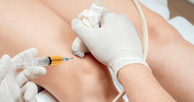 تزریق پی آر پی زانو